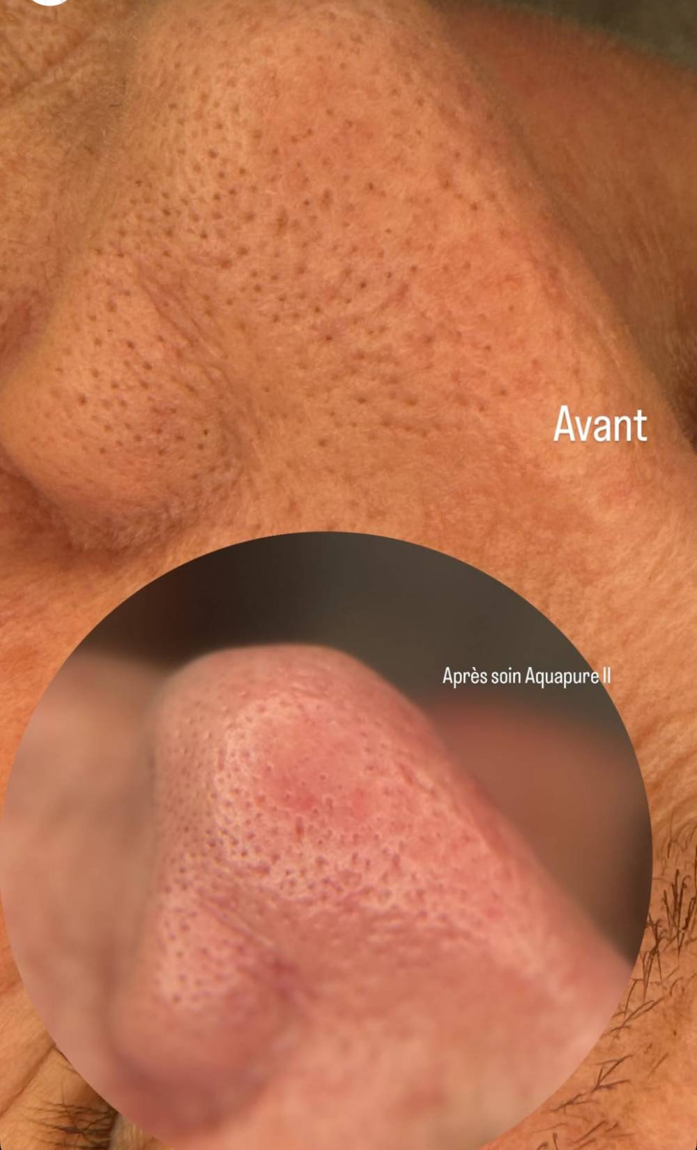 Aquapure 2 (2)